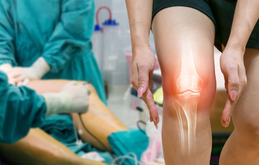 traumatologo-para-fracturas-en-culiacan-sinaloa
